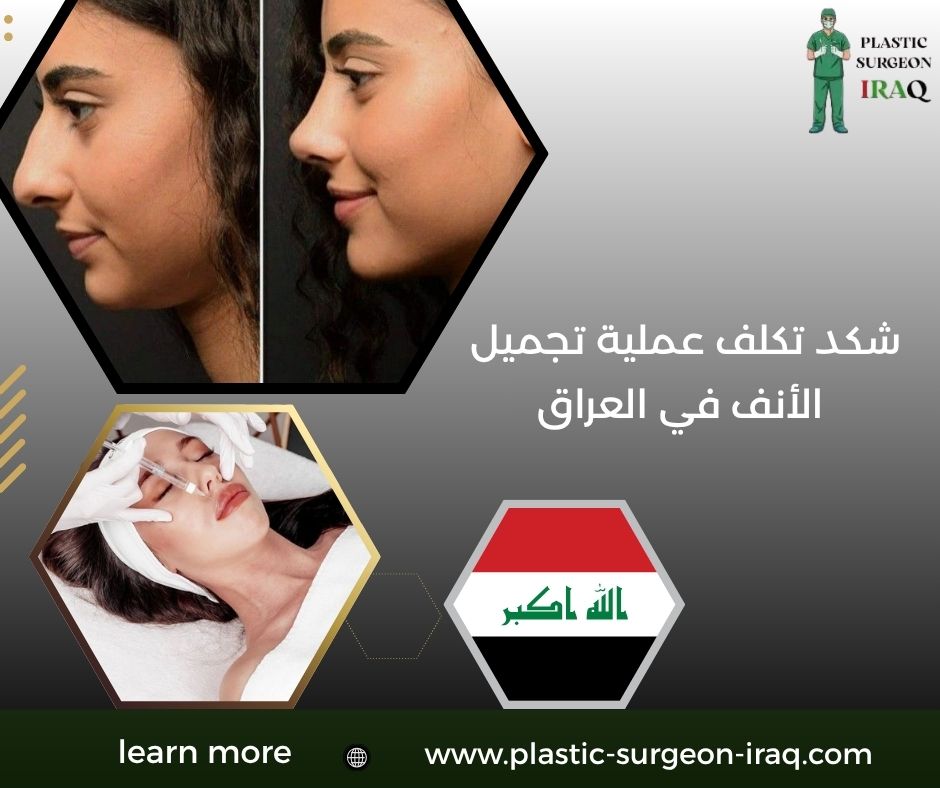 شكد تكلف عملية تجميل الأنف في العراق