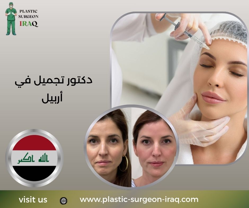 دكتور تجميل في أربيل
