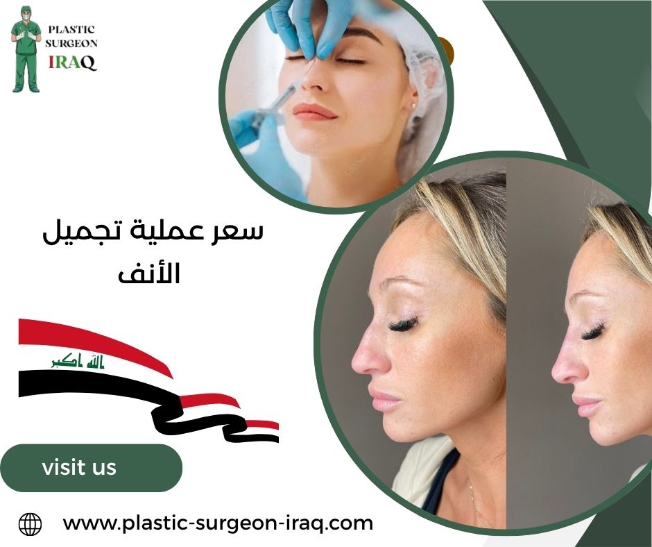 سعر عملية تجميل الأنف