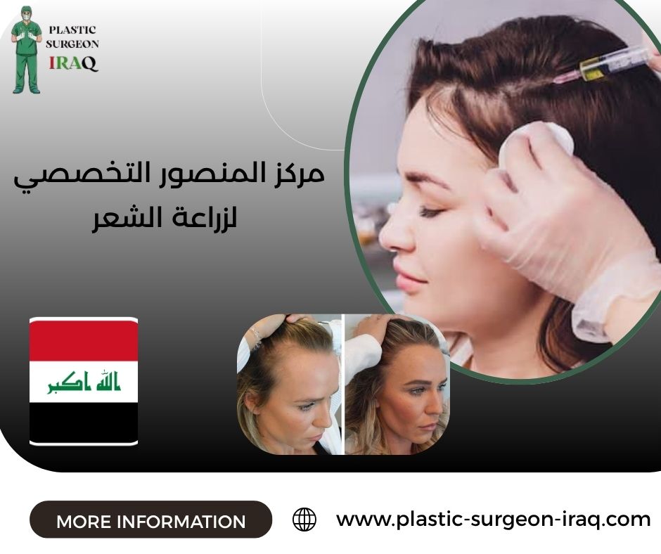 مركز المنصور التخصصي لزراعة الشعر