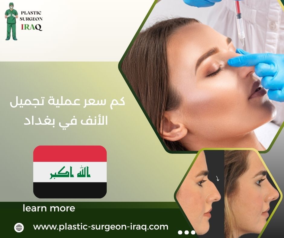 كم سعر عملية تجميل الأنف في بغداد