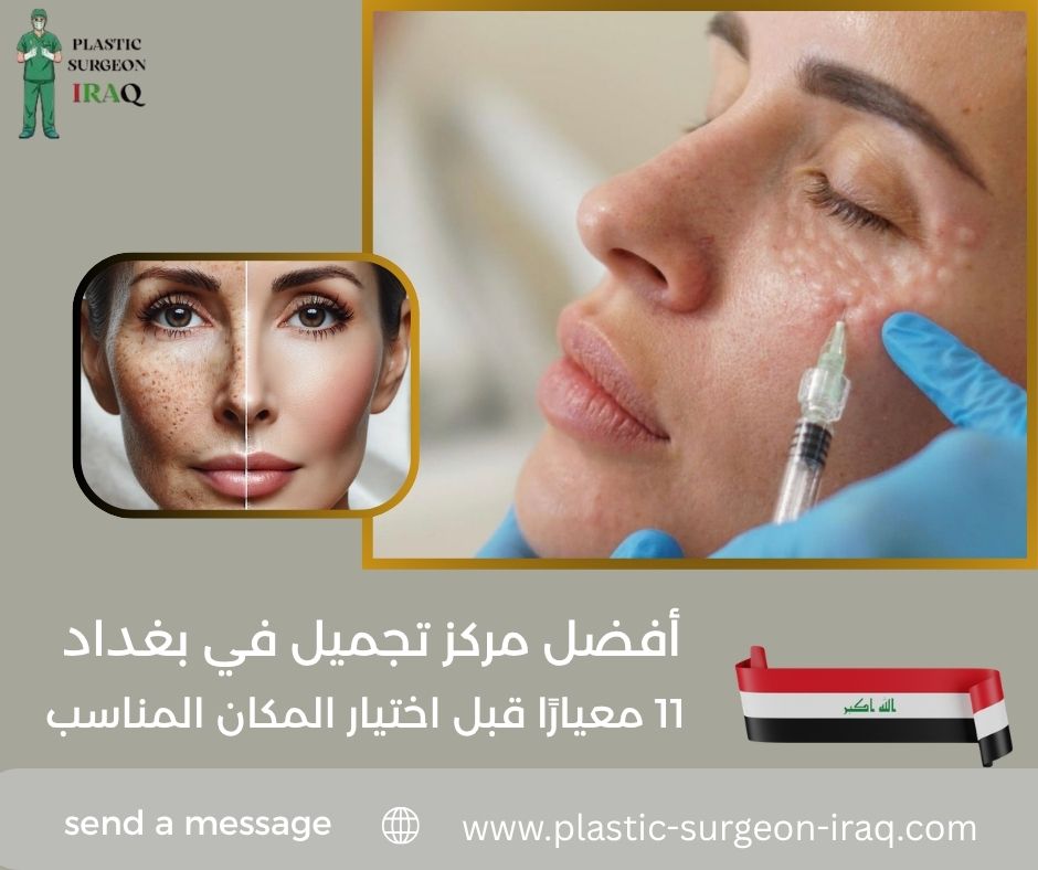 أفضل مركز تجميل في بغداد