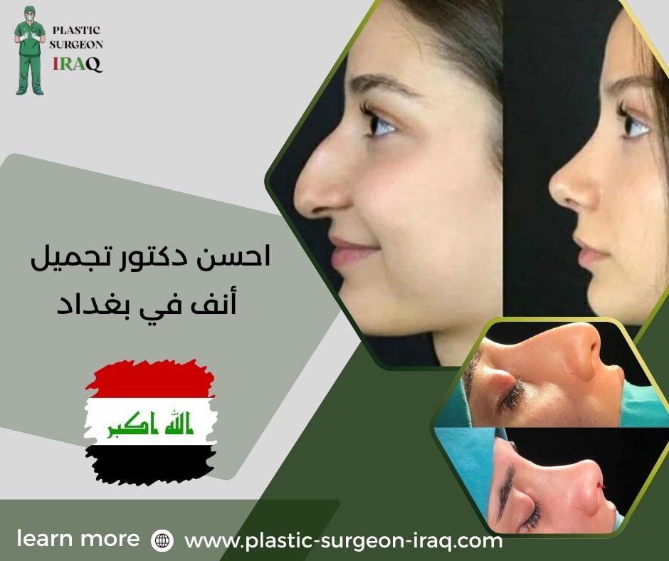 احسن دكتور تجميل أنف في بغداد