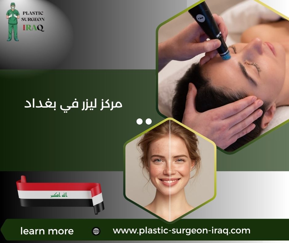 مركز ليزر في بغداد