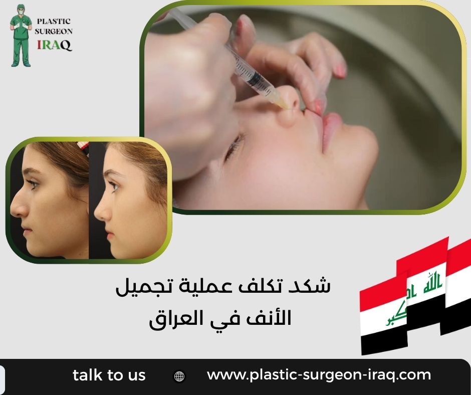 شكد تكلف عملية تجميل الأنف في العراق