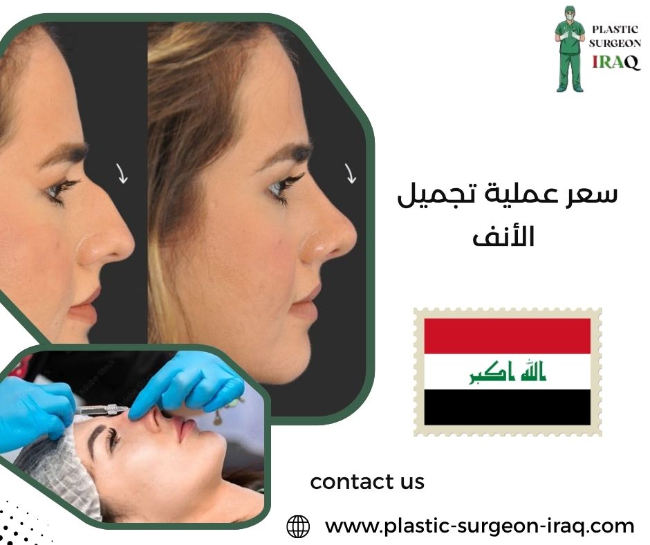 سعر عملية تجميل الأنف