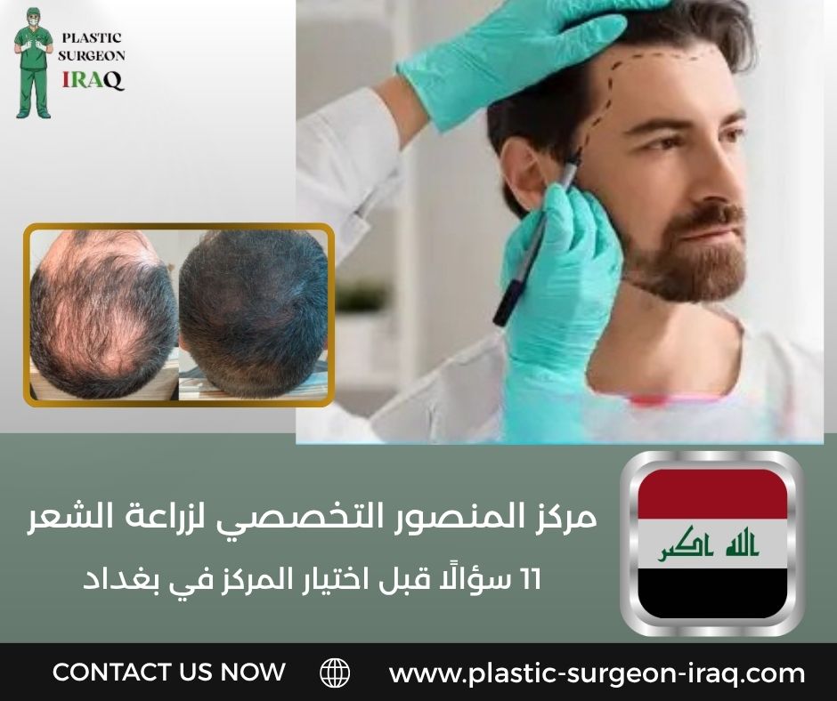 مركز المنصور التخصصي لزراعة الشعر