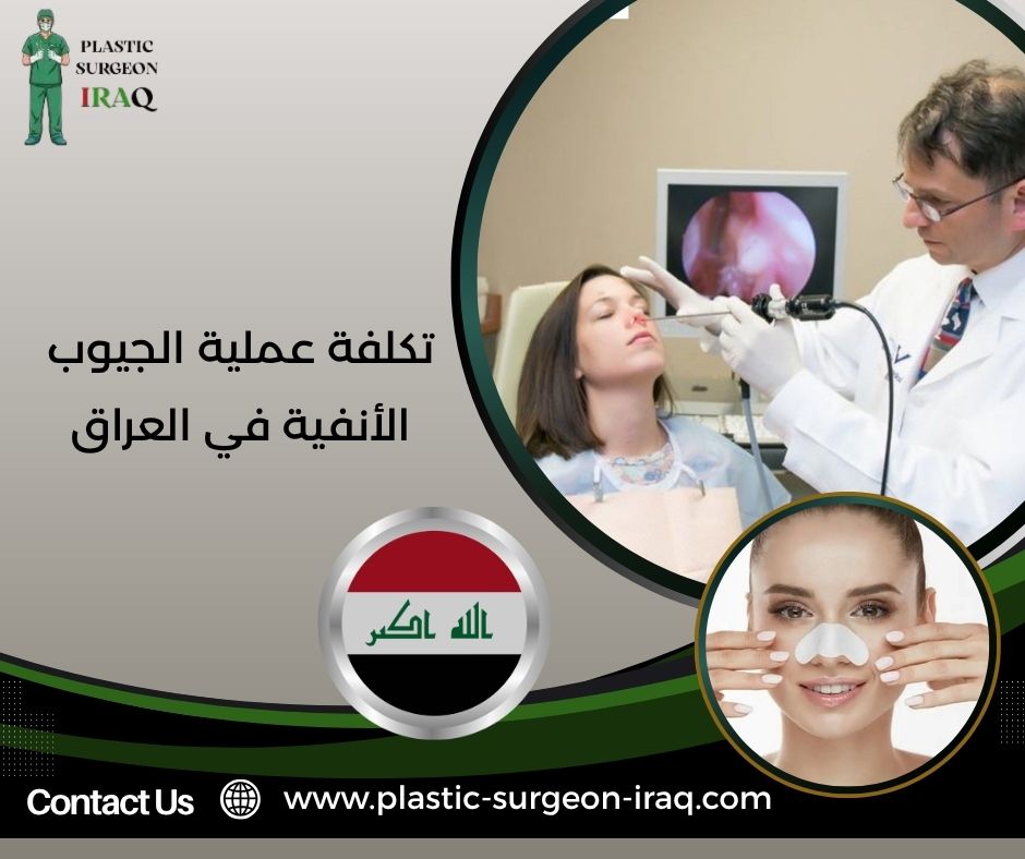 تكلفة عملية الجيوب الأنفية في العراق