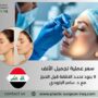 سعر عملية تجميل الأنف
