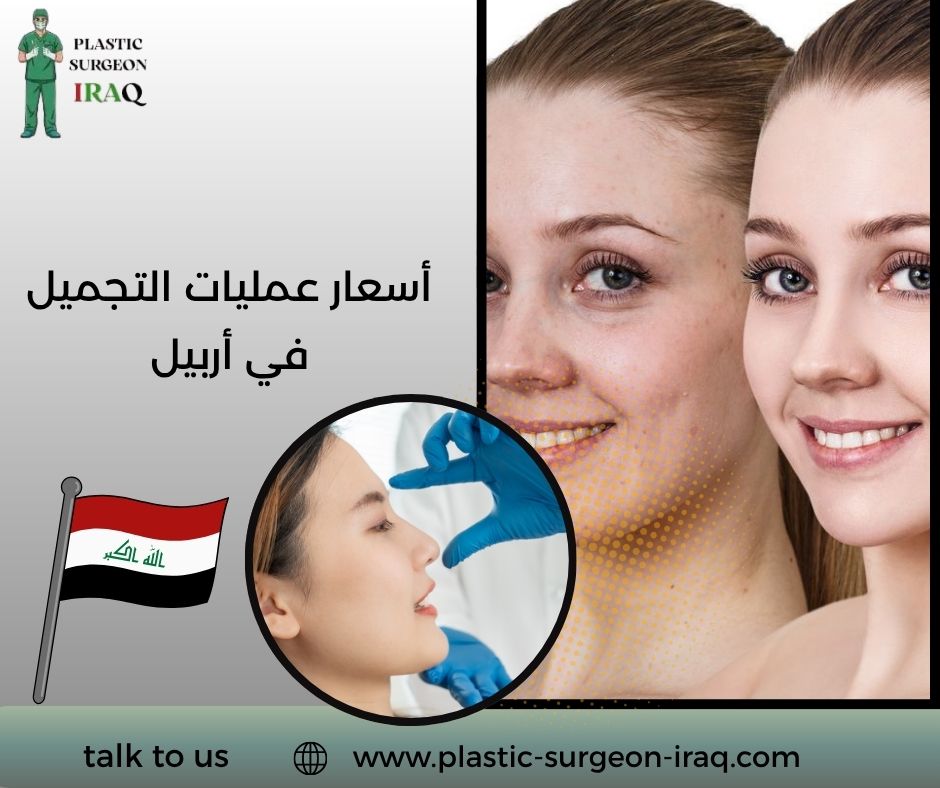 أسعار عمليات التجميل في أربيل