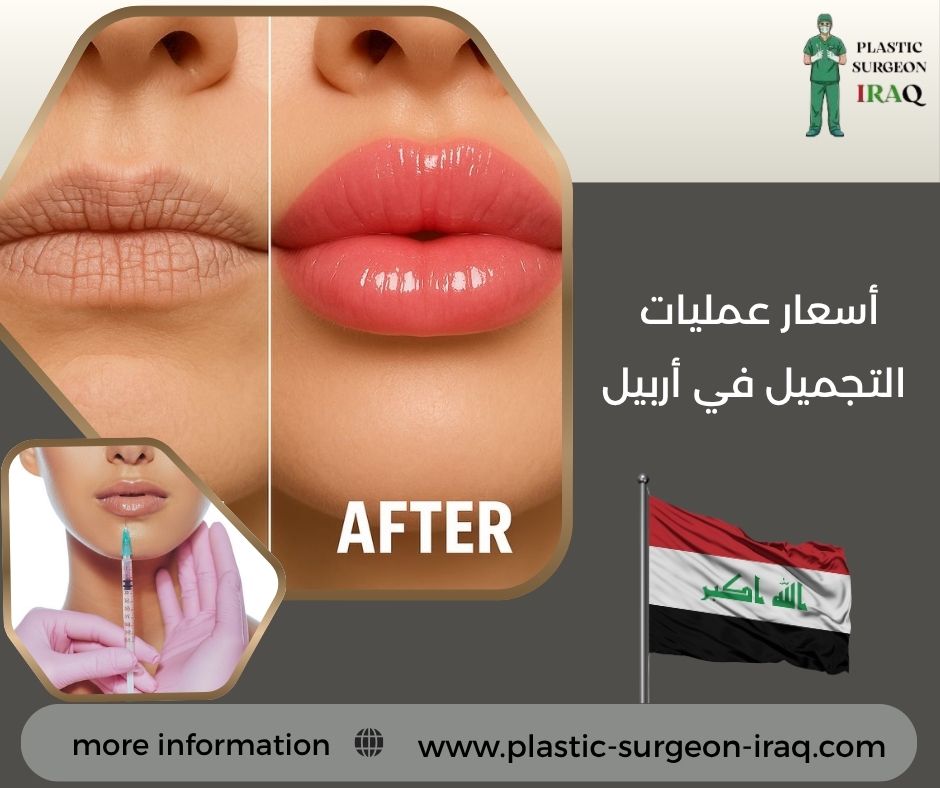 أسعار عمليات التجميل في أربيل