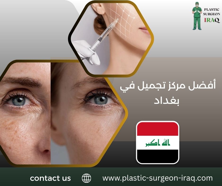أفضل مركز تجميل في بغداد