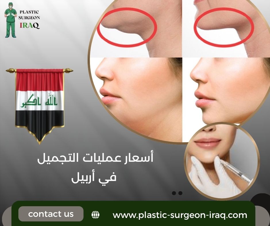 أسعار عمليات التجميل في أربيل