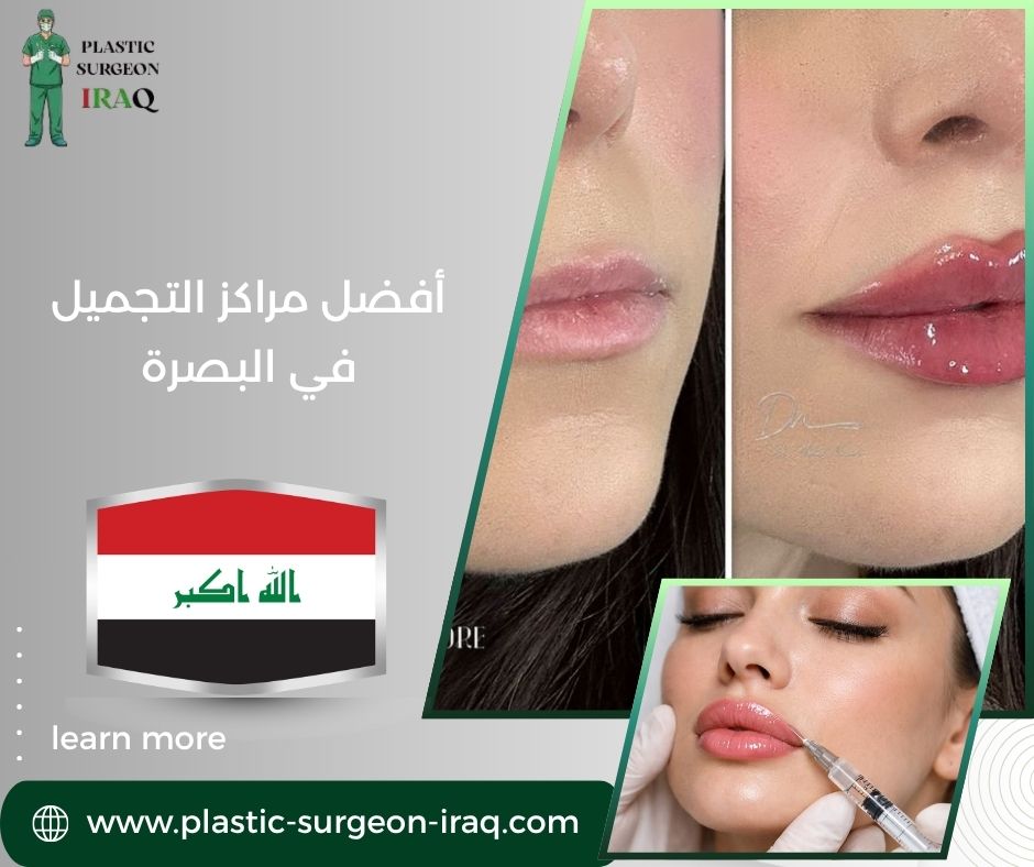 أفضل مراكز التجميل في البصرة