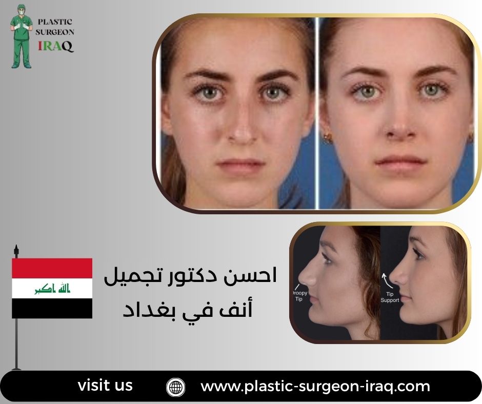 احسن دكتور تجميل أنف في بغداد
