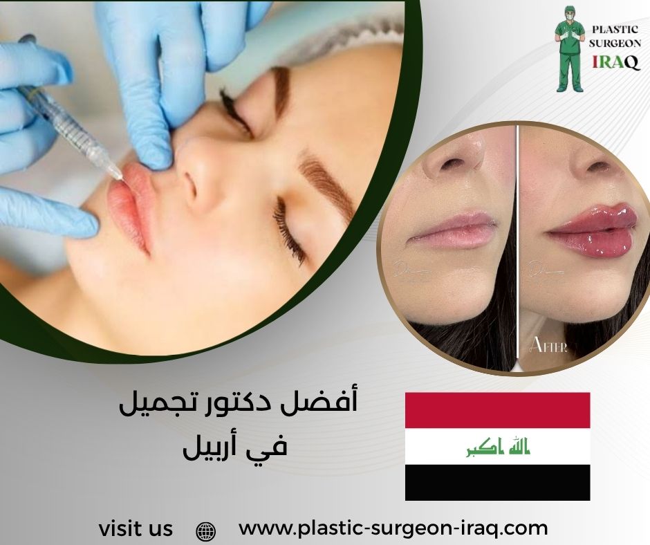 أفضل دكتور تجميل في أربيل