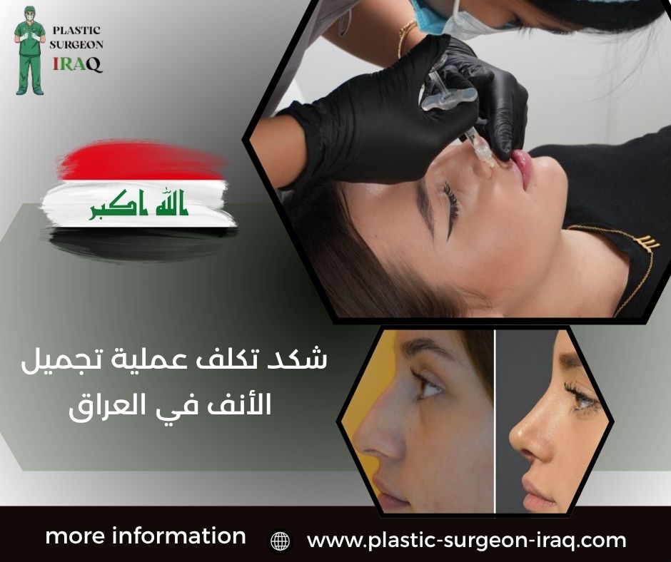 شكد تكلف عملية تجميل الأنف في العراق