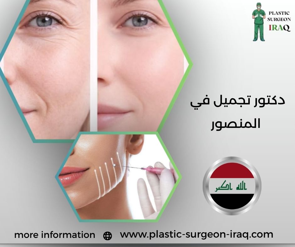 دكتور تجميل في المنصور