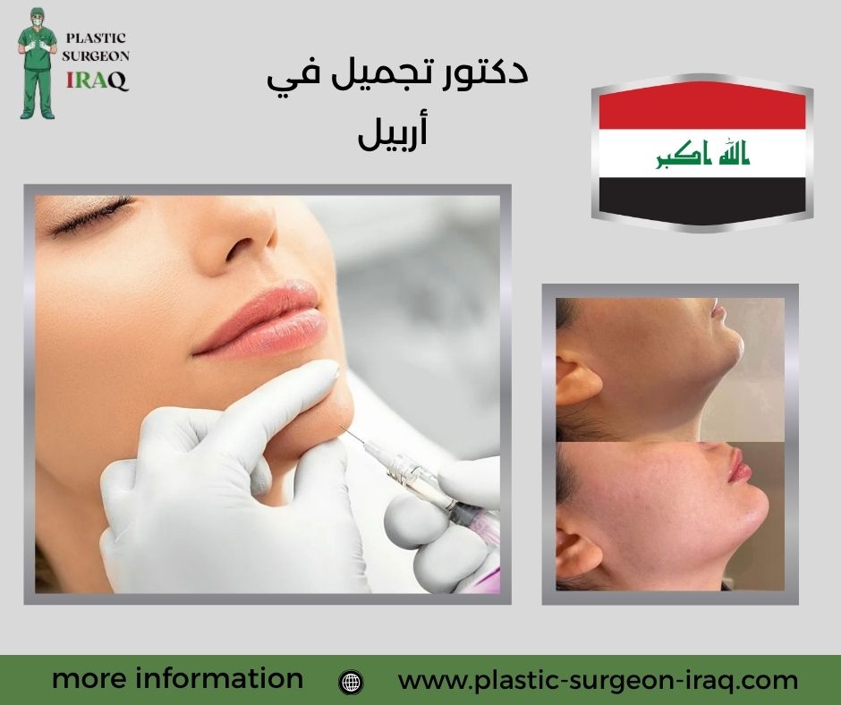 دكتور تجميل في أربيل