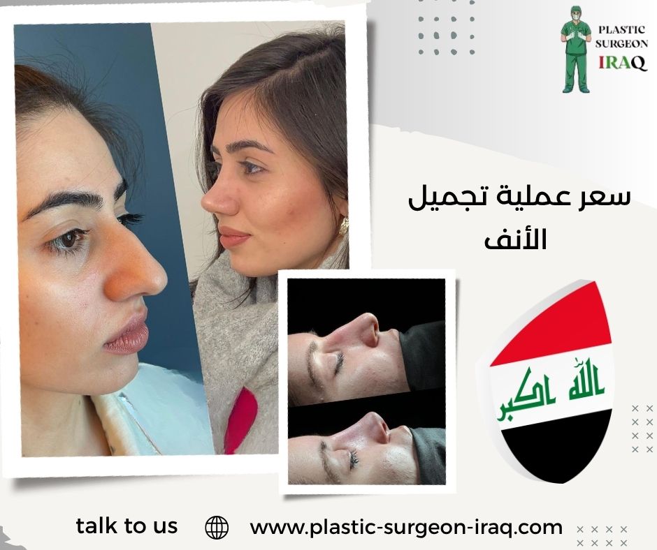 سعر عملية تجميل الأنف