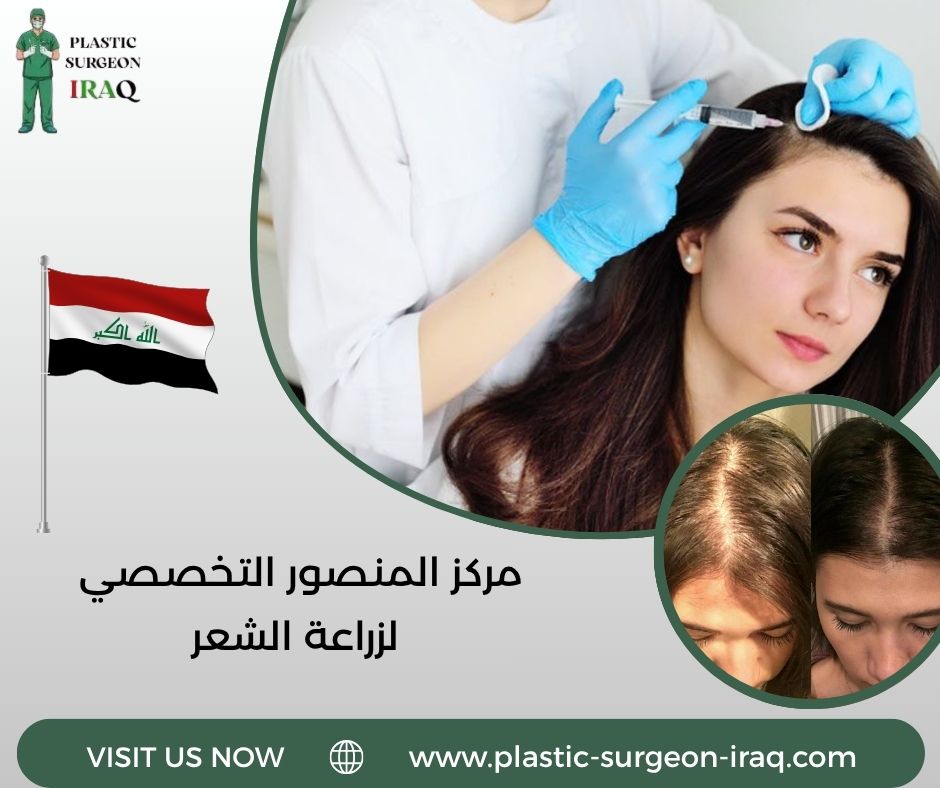 مركز المنصور التخصصي لزراعة الشعر