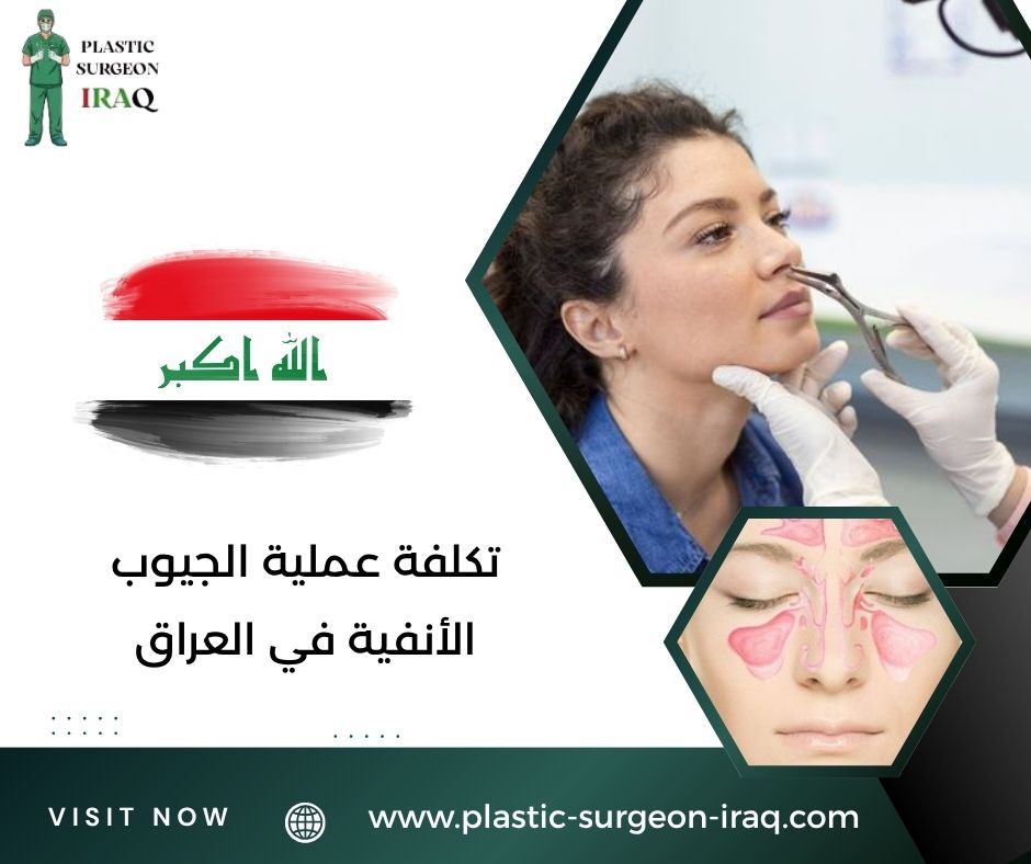 تكلفة عملية الجيوب الأنفية في العراق