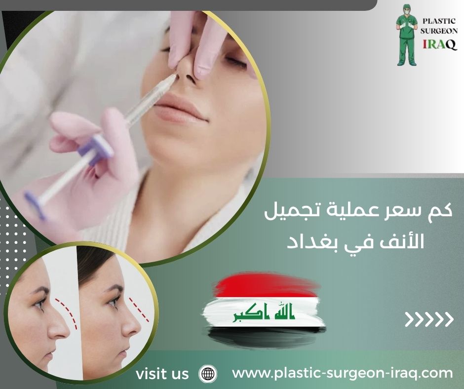 كم سعر عملية تجميل الأنف في بغداد