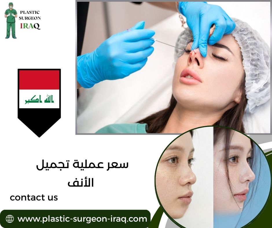 سعر عملية تجميل الأنف