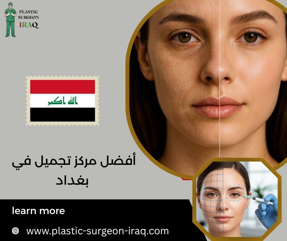 أفضل مركز تجميل في بغداد