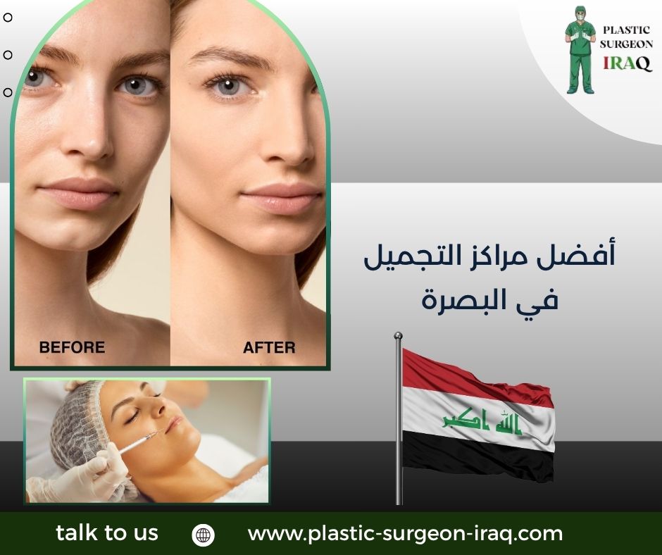 أفضل مراكز التجميل في البصرة