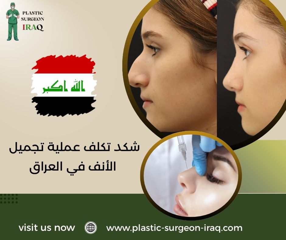 شكد تكلف عملية تجميل الأنف في العراق
