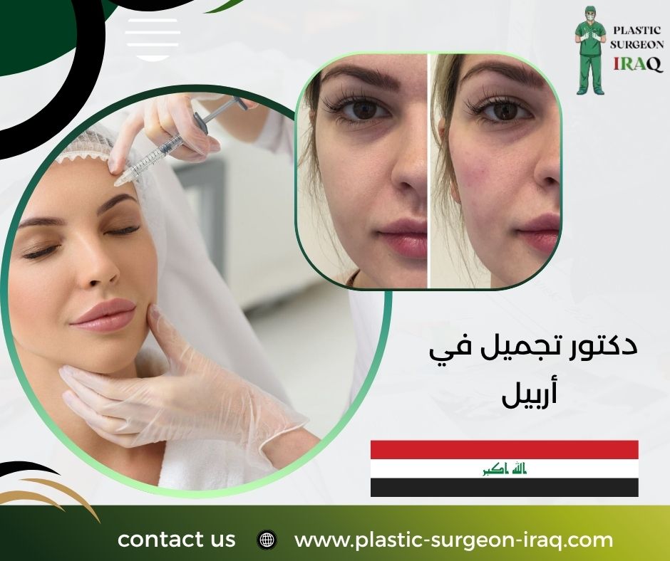 دكتور تجميل في أربيل