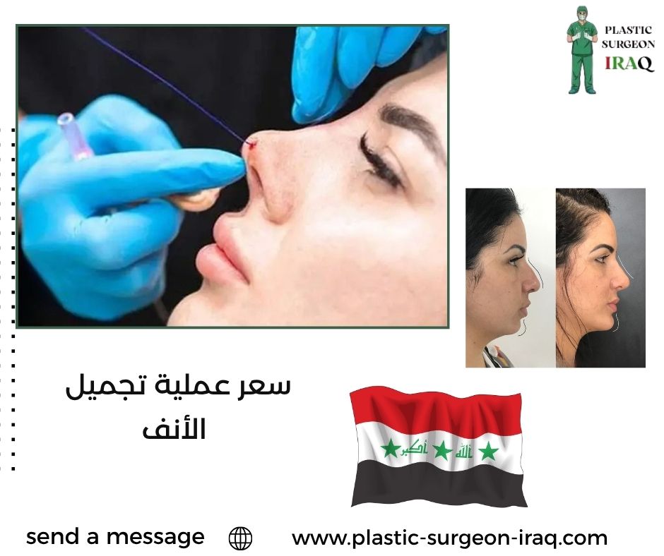 سعر عملية تجميل الأنف
