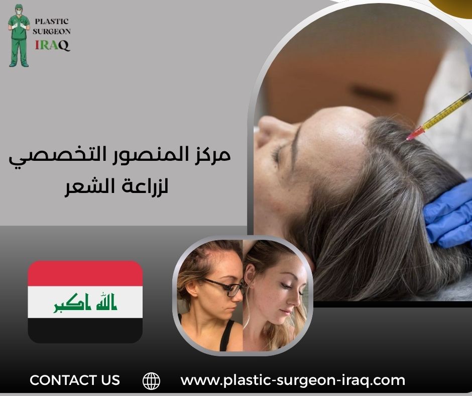 مركز المنصور التخصصي لزراعة الشعر