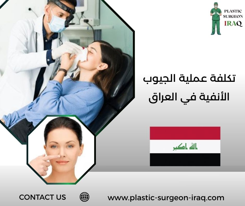 تكلفة عملية الجيوب الأنفية في العراق