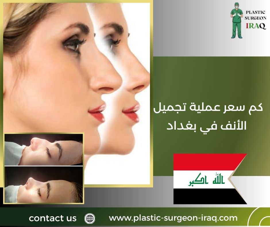 كم سعر عملية تجميل الأنف في بغداد