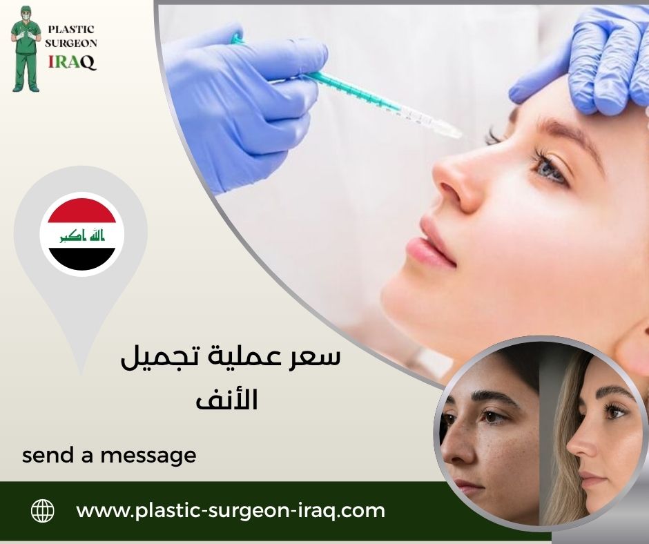 سعر عملية تجميل الأنف