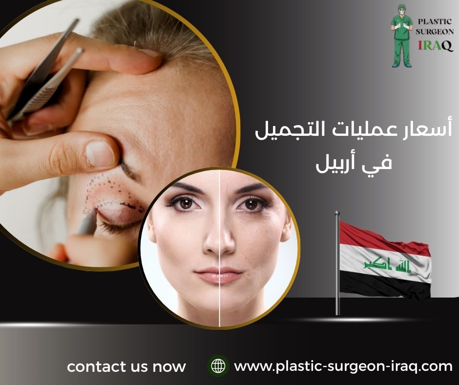 أسعار عمليات التجميل في أربيل
