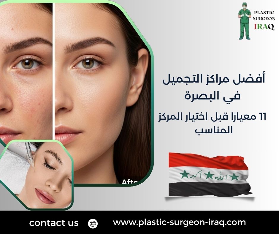 أفضل مراكز التجميل في البصرة