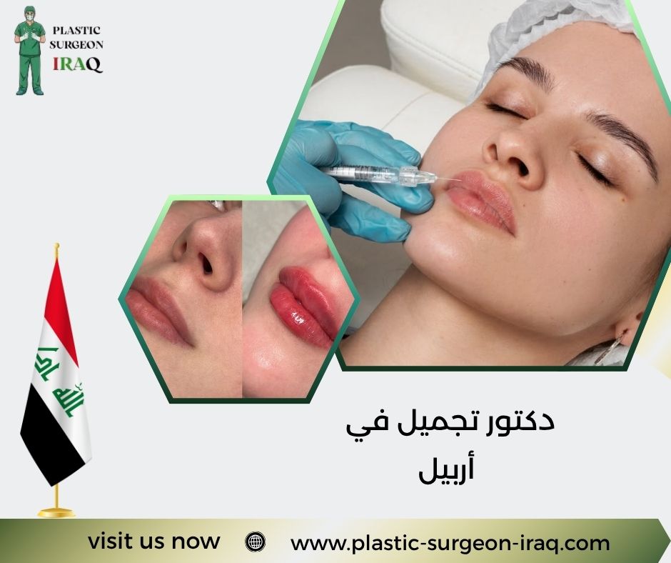 دكتور تجميل في أربيل