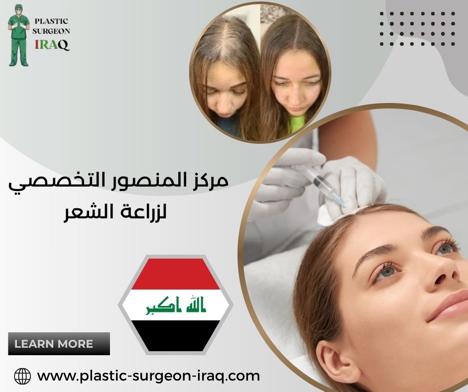مركز المنصور التخصصي لزراعة الشعر