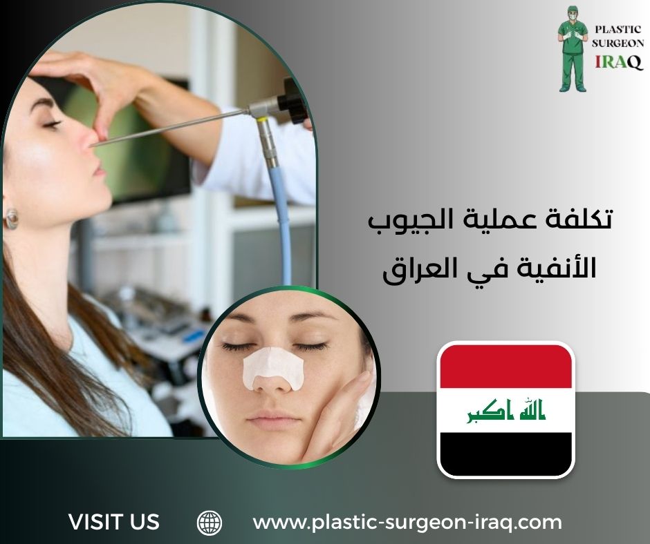 تكلفة عملية الجيوب الأنفية في العراق