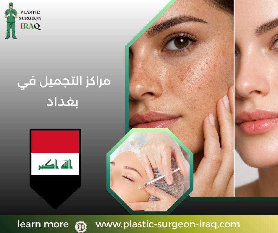 مراكز التجميل في بغداد