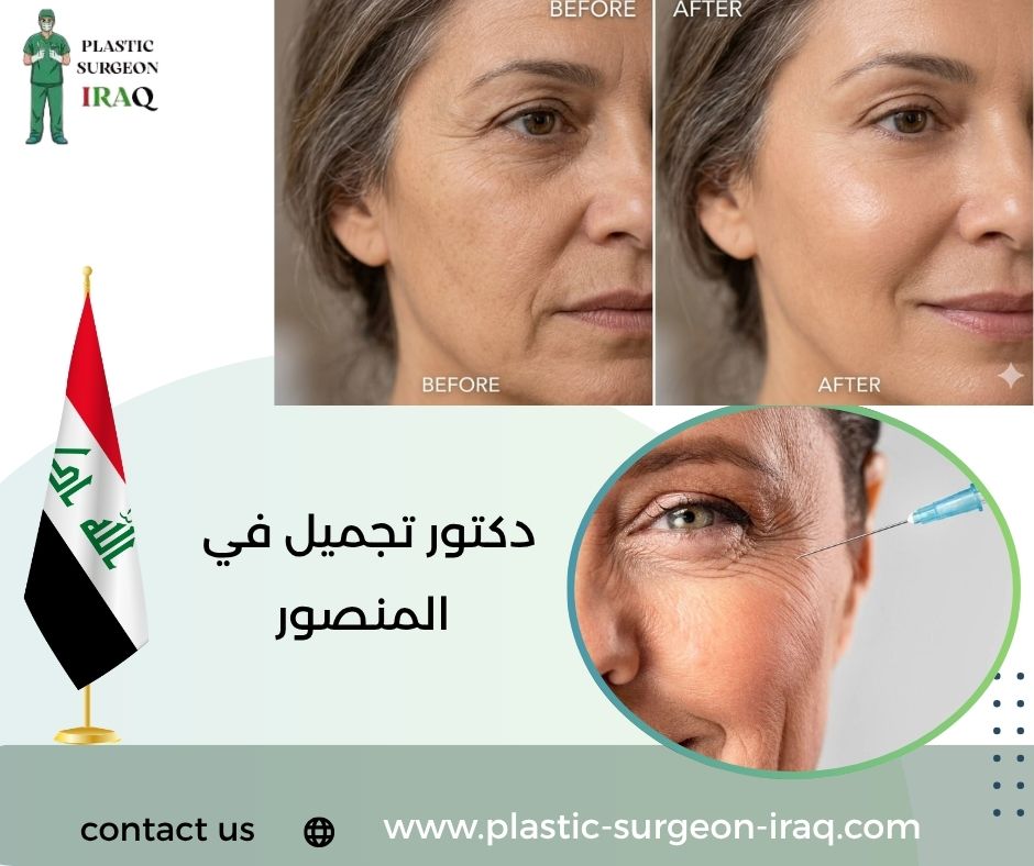 دكتور تجميل في المنصور