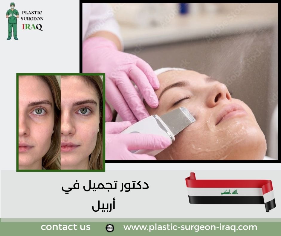دكتور تجميل في أربيل