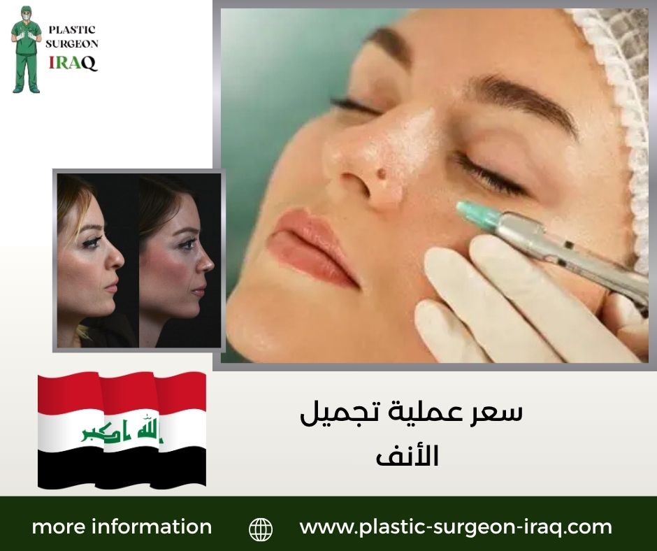 سعر عملية تجميل الأنف