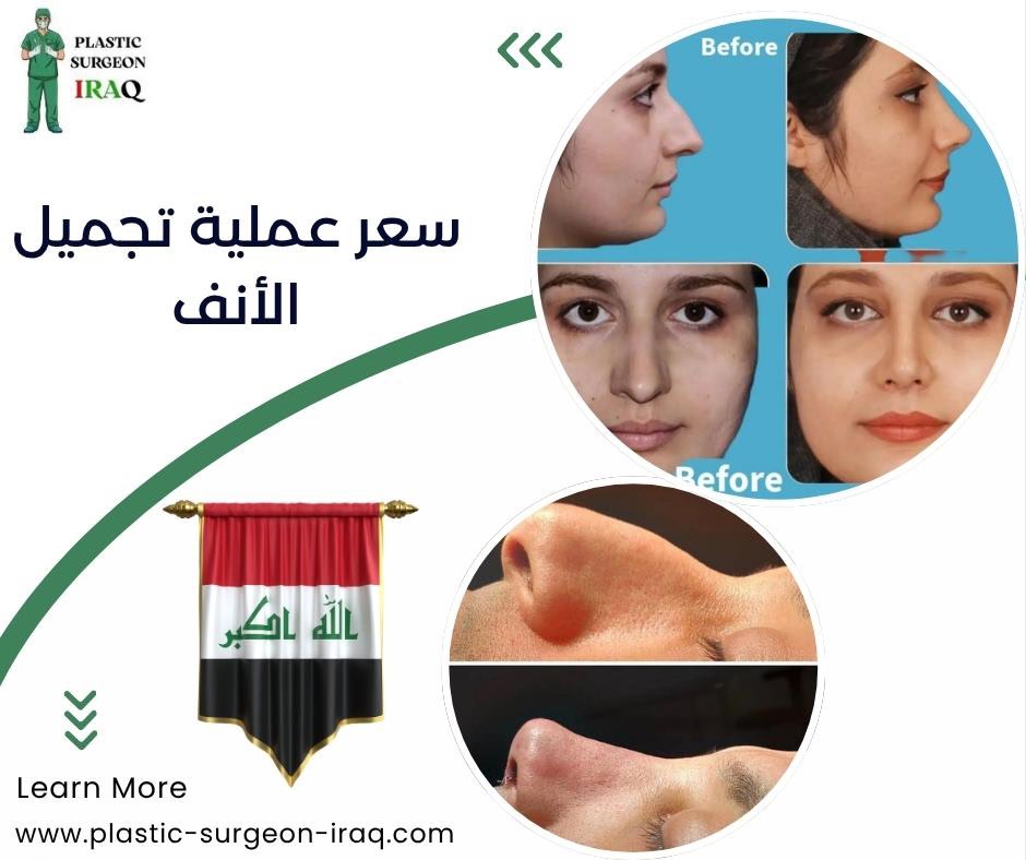 سعر عملية تجميل الأنف