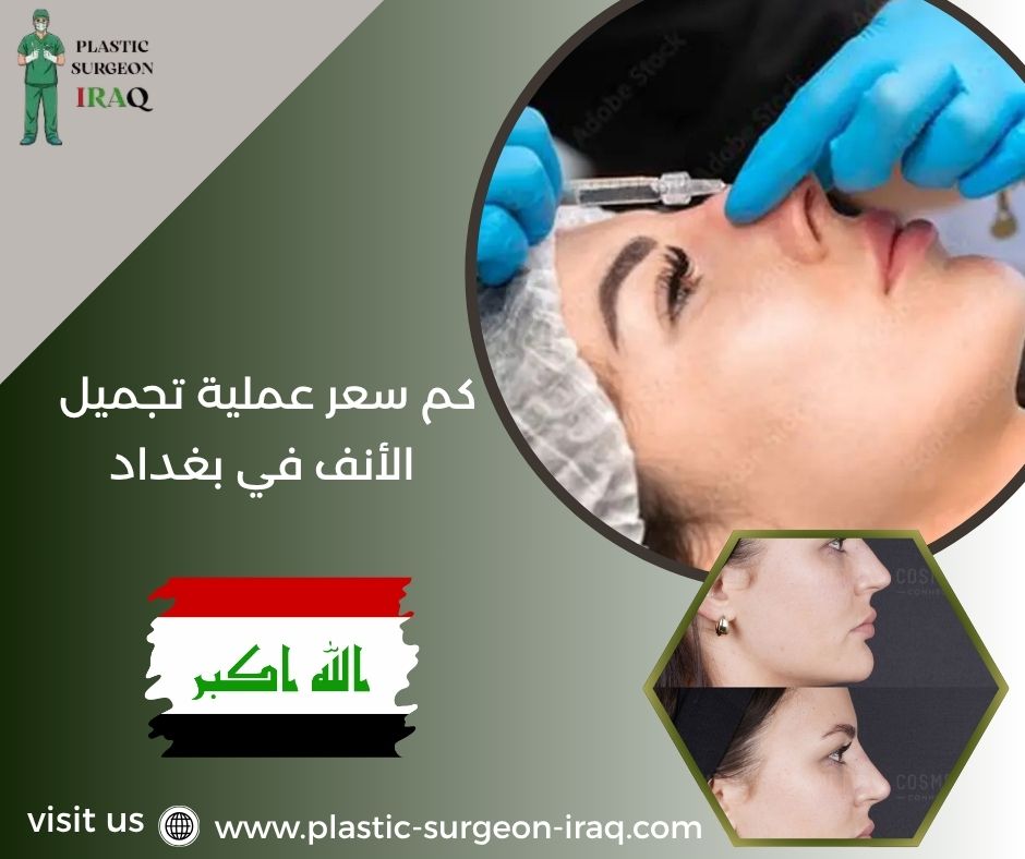 كم سعر عملية تجميل الأنف في بغداد