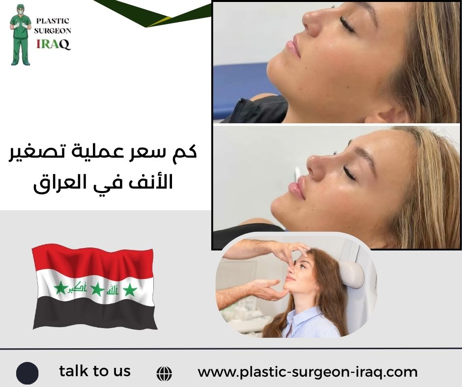 كم سعر عملية تصغير الأنف في العراق